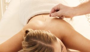 acupuncture-needles-back-pain